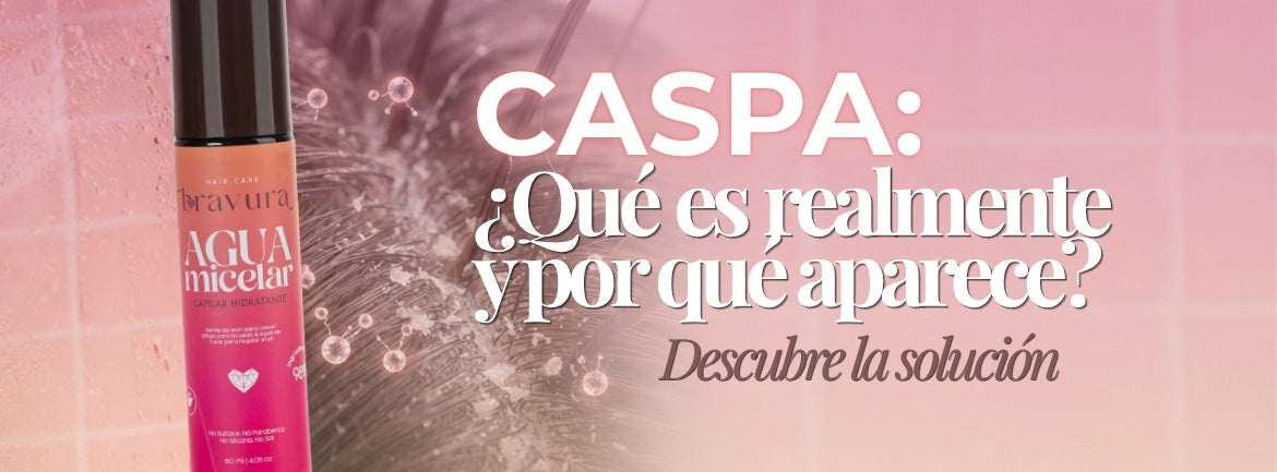 ¿Qué es la caspa y por qué aparece?