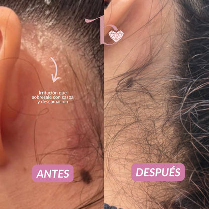 Agua Micelar Capilar Bravura 150ml